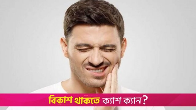 দাঁত শিরশির করার কারণ ও প্রতিকার